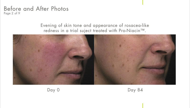 before_after_2.jpg